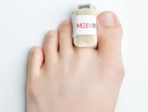 요즘 뜨는 발가락부목 TOP 제품